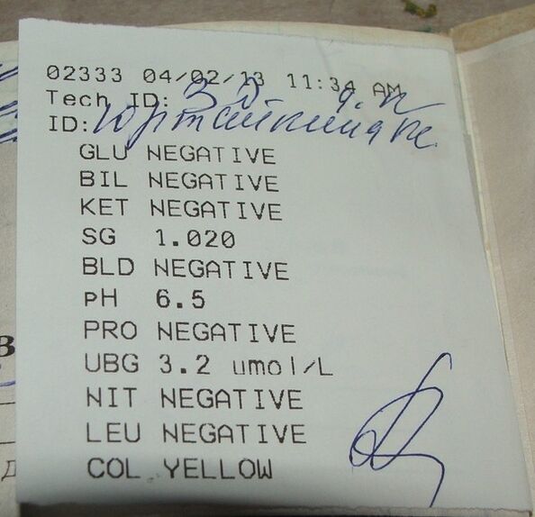 Rezultatele analizei urinei mele înainte de femixal